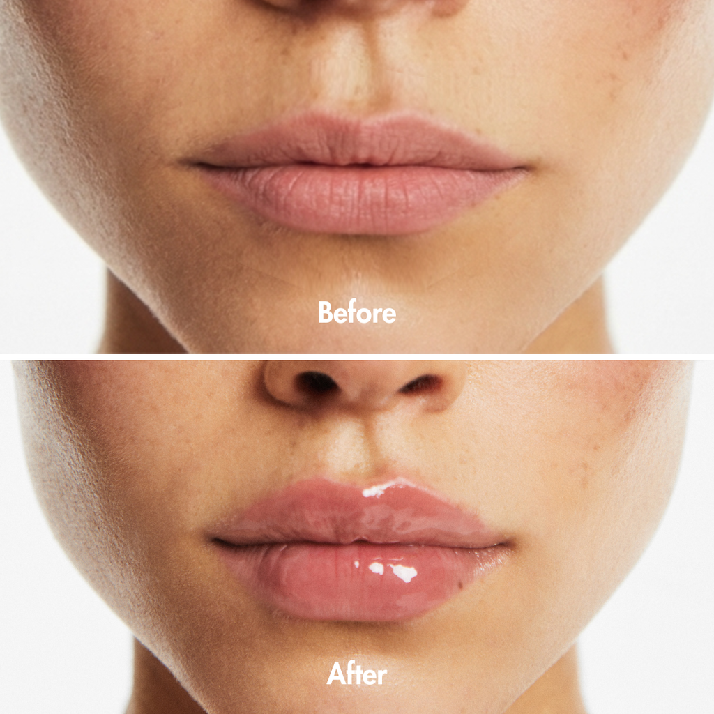 Kissaya Extreme Lip Plumper: Volume Instantané
